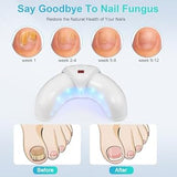 Nail Fungus Cleaning Device