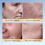 SADOER - 7% Glycolic Acid + Ceramide Facial Toner - 230ml