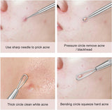 Beauty Tool Set - Pimple Popper Tool Kit - 4pcs