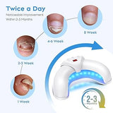 Nail Fungus Cleaning Device