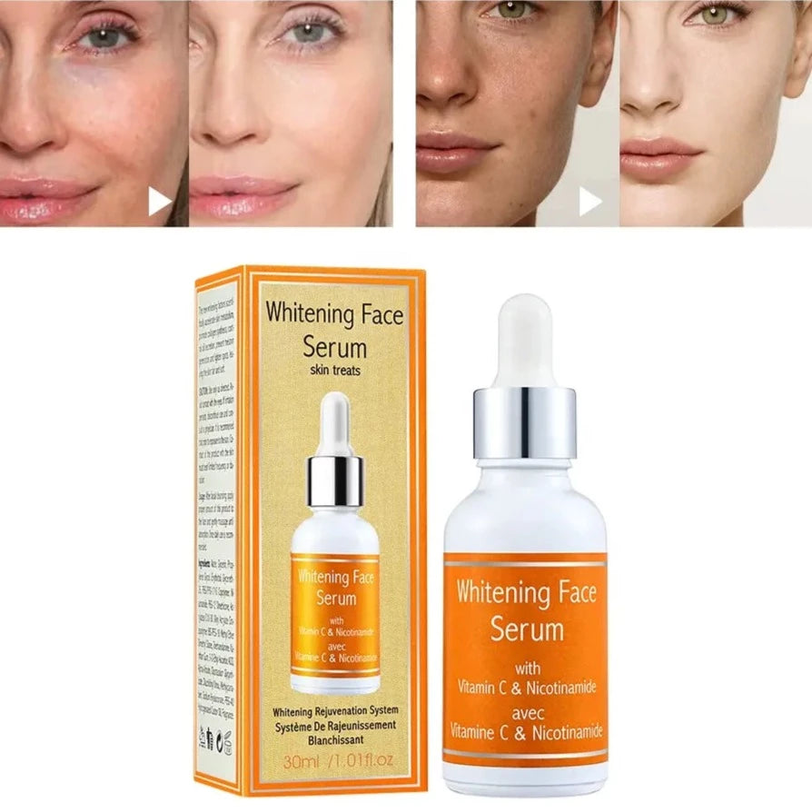 Whitening Face Serum - Vit C - Nicotinamide – Madz Nail & Beauty