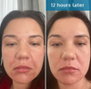 O2SkinPro® - Skin Tonic - Spa Treatment