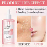 Sadoer - Himalayan Pink Salt - Firming Pores Moist Serum - 100ml