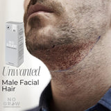 Male Beard Hair Remover & Growth Inhibitor - 90 ml