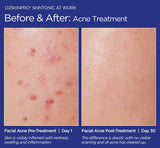 O2SkinPro® - Skin Tonic - Spa Treatment