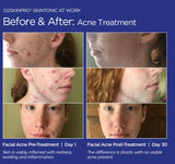 O2SkinPro® - Skin Tonic - Spa Treatment