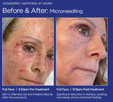 O2SkinPro® - Skin Tonic - Spa Treatment
