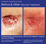 O2SkinPro® - Skin Tonic - Spa Treatment
