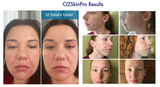 O2SkinPro® - Skin Tonic - Spa Treatment