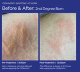 O2SkinPro® - Skin Tonic - Spa Treatment