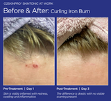 O2SkinPro® - Skin Tonic - Spa Treatment