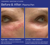 O2SkinPro® - Skin Tonic - Spa Treatment