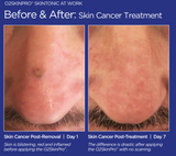 O2SkinPro® - Skin Tonic - Spa Treatment