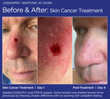 O2SkinPro® - Skin Tonic - Spa Treatment
