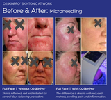 O2SkinPro® - Skin Tonic - Spa Treatment