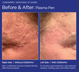 O2SkinPro® - Skin Tonic - Spa Treatment