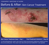 O2SkinPro® - Skin Tonic - Spa Treatment
