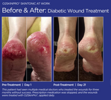 O2SkinPro® - Skin Tonic - Spa Treatment