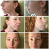 O2SkinPro® - Skin Tonic - Spa Treatment